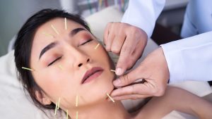 5 Manfaat Akupuntur Kecantikan dan Kisaran Harga, Sepadan!